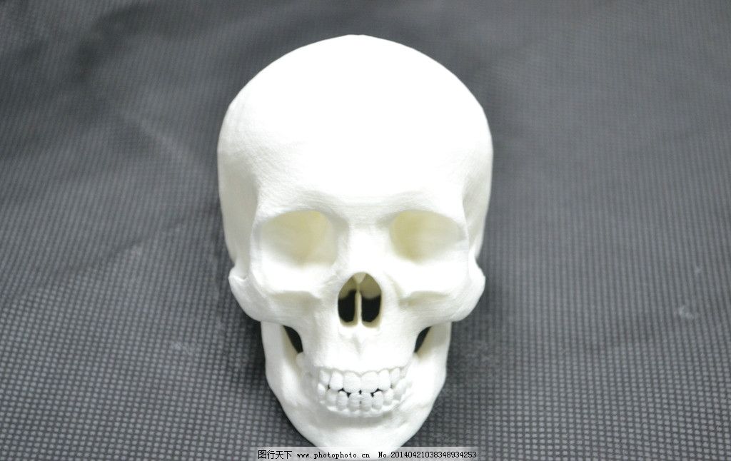 3D打印头盖骨图片